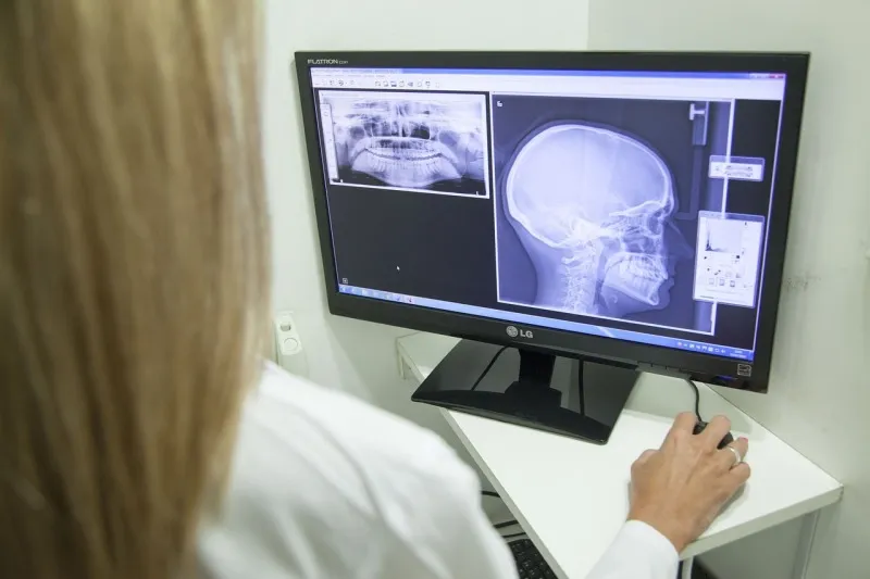 Teleradiologia - alternatywa dla klasycznych opisów